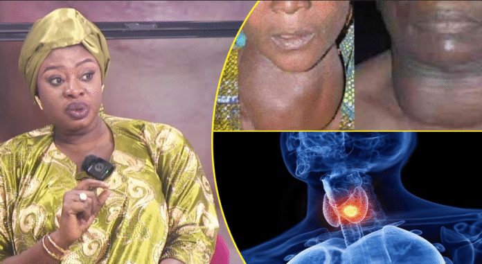 De la maladie à l’engagement : le témoignage de la Présidente de l'association des malades de la thyroïde